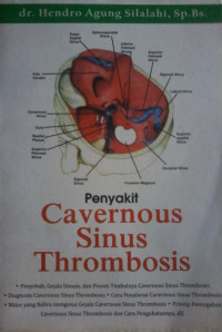 PENYAKIT CAVERNOUS SINUS THROMBOSIS