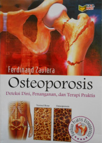 OSTEOPOROSIS: DETEKSI DINI, PENANGANAN, DAN TERAPI PRAKTIS